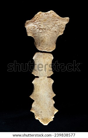 Anterior view of sternum bone - stock photo