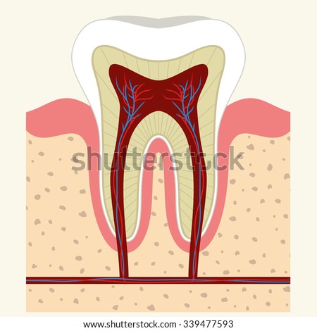 root canal Essay Examples