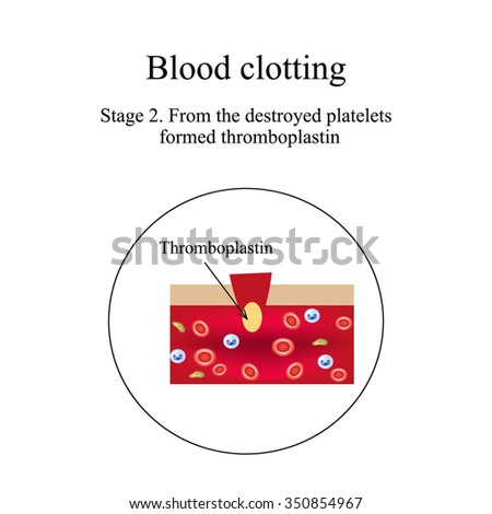 blood clotting 2 essay Irreducible complexity an essay in support of creationism published in 1994 referred to bacterial flagella as showing (2) the blood-clotting cascade. blood clotting 2 essay Irreducible complexity an essay in support of creationism published in 1994 referred to bacterial flagella as showing (2) the blood-clotting cascade.