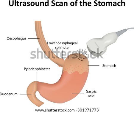 serenalyburkol