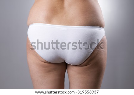 Thick Legs Stock Photos Images Pictures Shutterstock