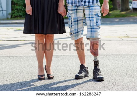 black runners with prothesis black runners with prothesis