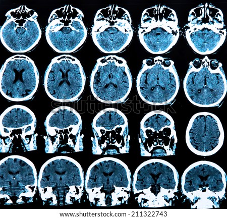 Brain Scan Stock Photos, Images, & Pictures | Shutterstock