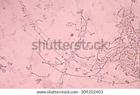 Yeast Cells Stock Photos, Images, & Pictures | Shutterstock