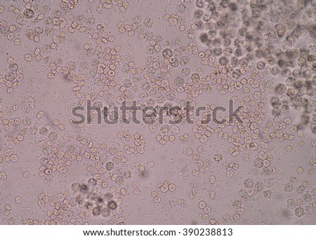 Infectious Disease Stock Photos, Images, & Pictures | Shutterstock