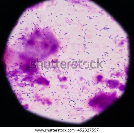 Gram-positive Stock Photos, Images, & Pictures | Shutterstock