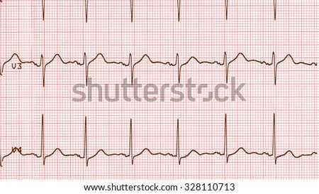 Electrocardiography Stock Photos, Images, & Pictures | Shutterstock