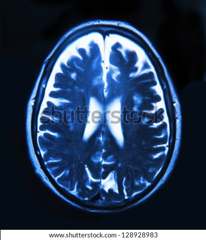 Brain Scan Stock Photos, Images, & Pictures | Shutterstock