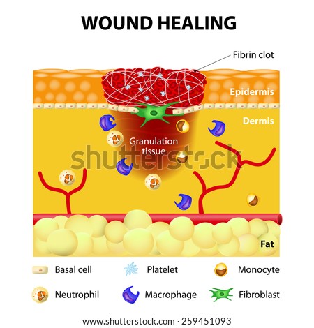 Wound Stock Photos, Images, & Pictures | Shutterstock