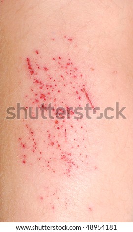 Cut Skin Stock Photos, Images, & Pictures | Shutterstock